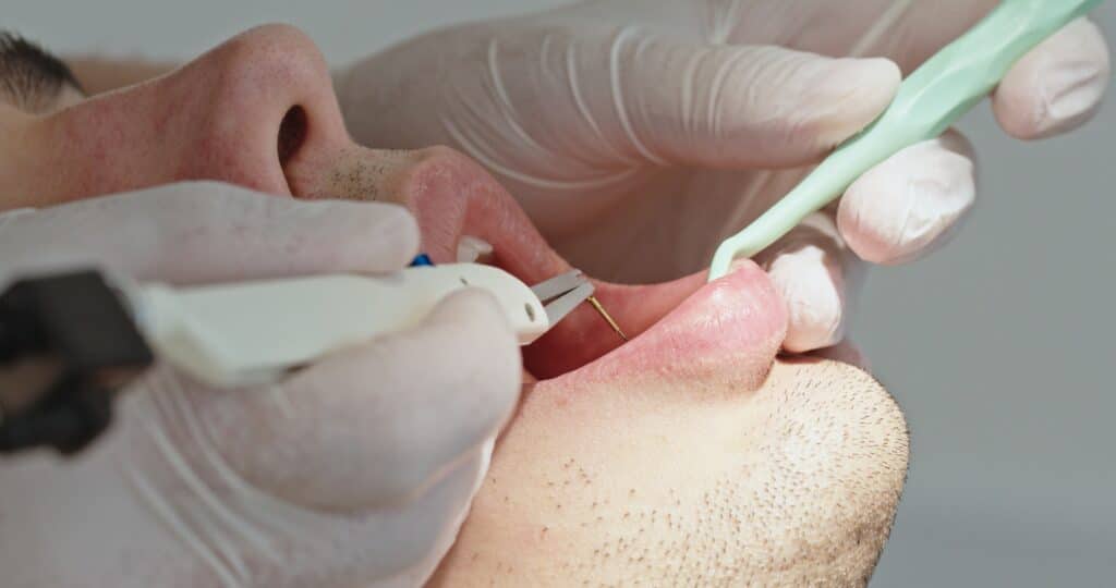 dentist performing periodontal probing