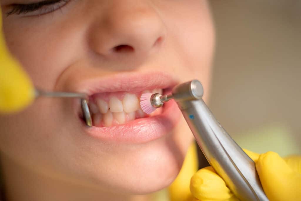 patient receiving a teeth cleaning