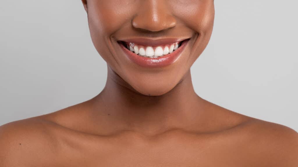 Patient with straight white teeth smiling