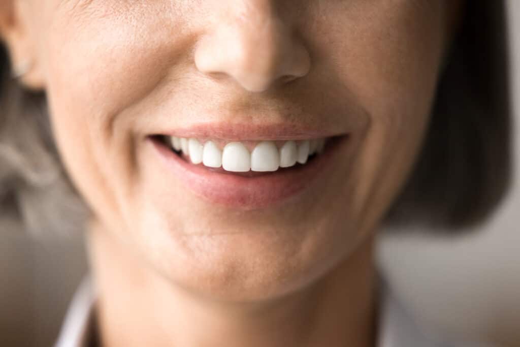 Dental patient smiling with strong healthy teeth