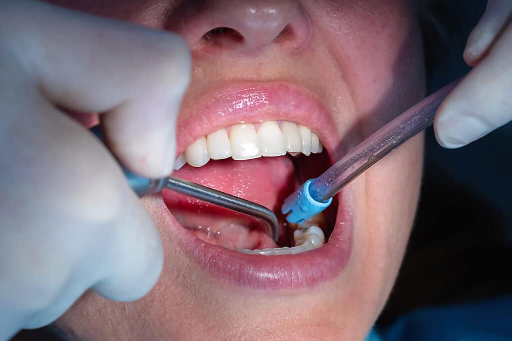 Patient receiving a dental ecam