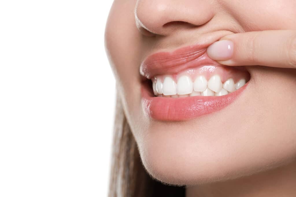 Patient showing their healthy gums